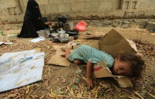 جهان باید چشمان خود را به مصایب یمن باز کند