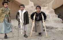 نه سال پس از جنگ در یمن، میلیون ها کودک آواره و گرسنه هستند