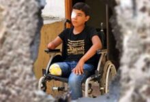 جنایت جنگی علیه کودکان قطع عضوشده غزه