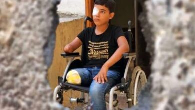 جنایت جنگی علیه کودکان قطع عضوشده غزه